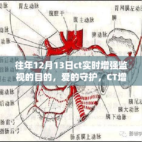 愛的守護，CT增強監(jiān)視下的暖心故事與實時增強監(jiān)視目的揭秘