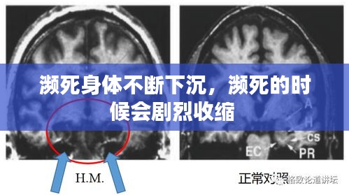 瀕死身體不斷下沉，瀕死的時(shí)候會劇烈收縮 