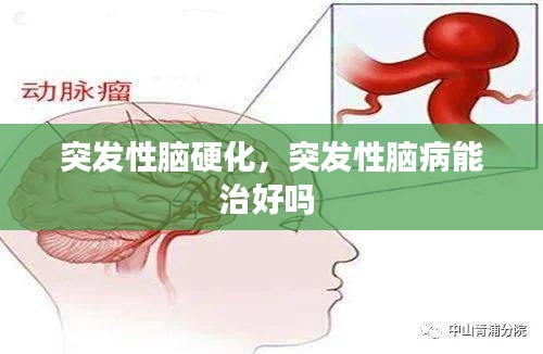 突發(fā)性腦硬化，突發(fā)性腦病能治好嗎 